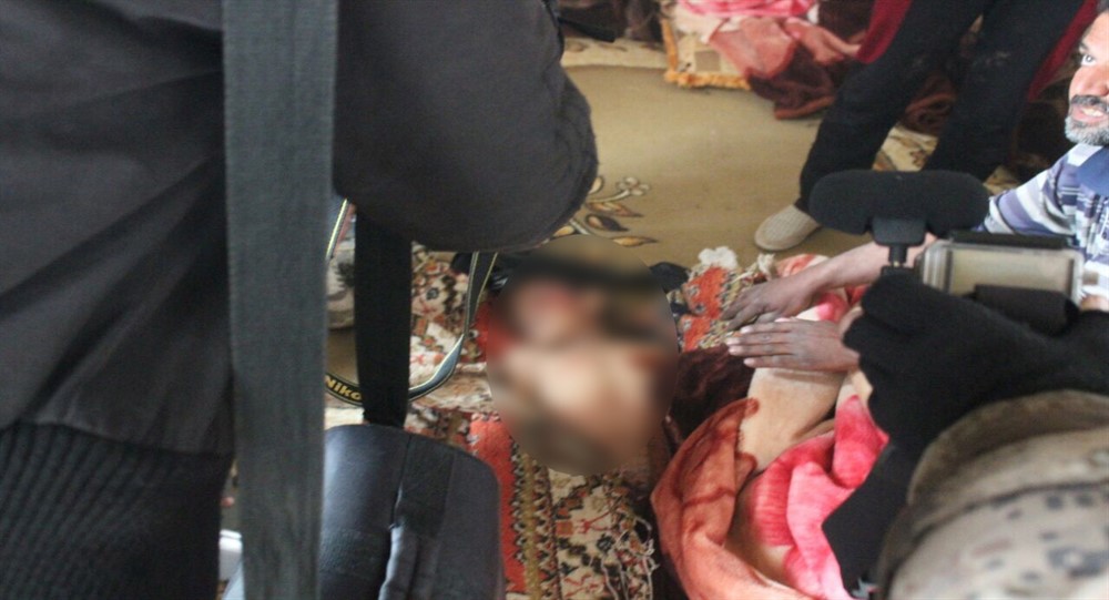 Трое детей стали жертвами снарядов боевиков ИГ