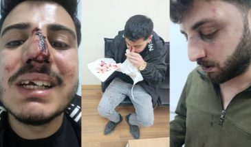 Трое братьев заявляют о пытках со стороны полиции в Ване